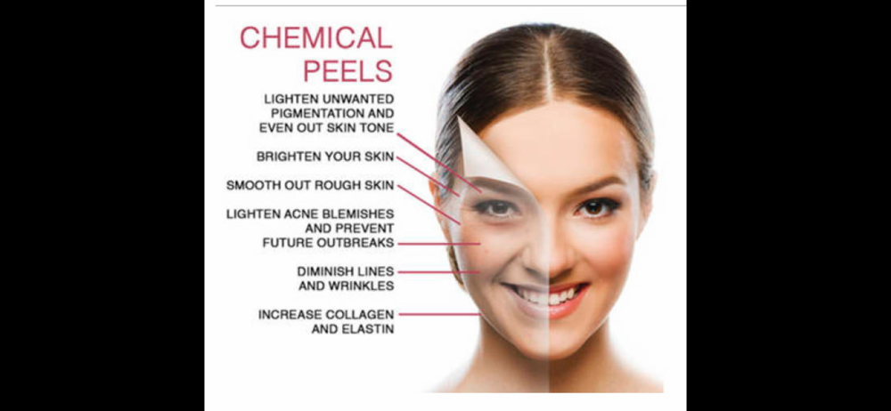 Series of 6 Chemical Peels