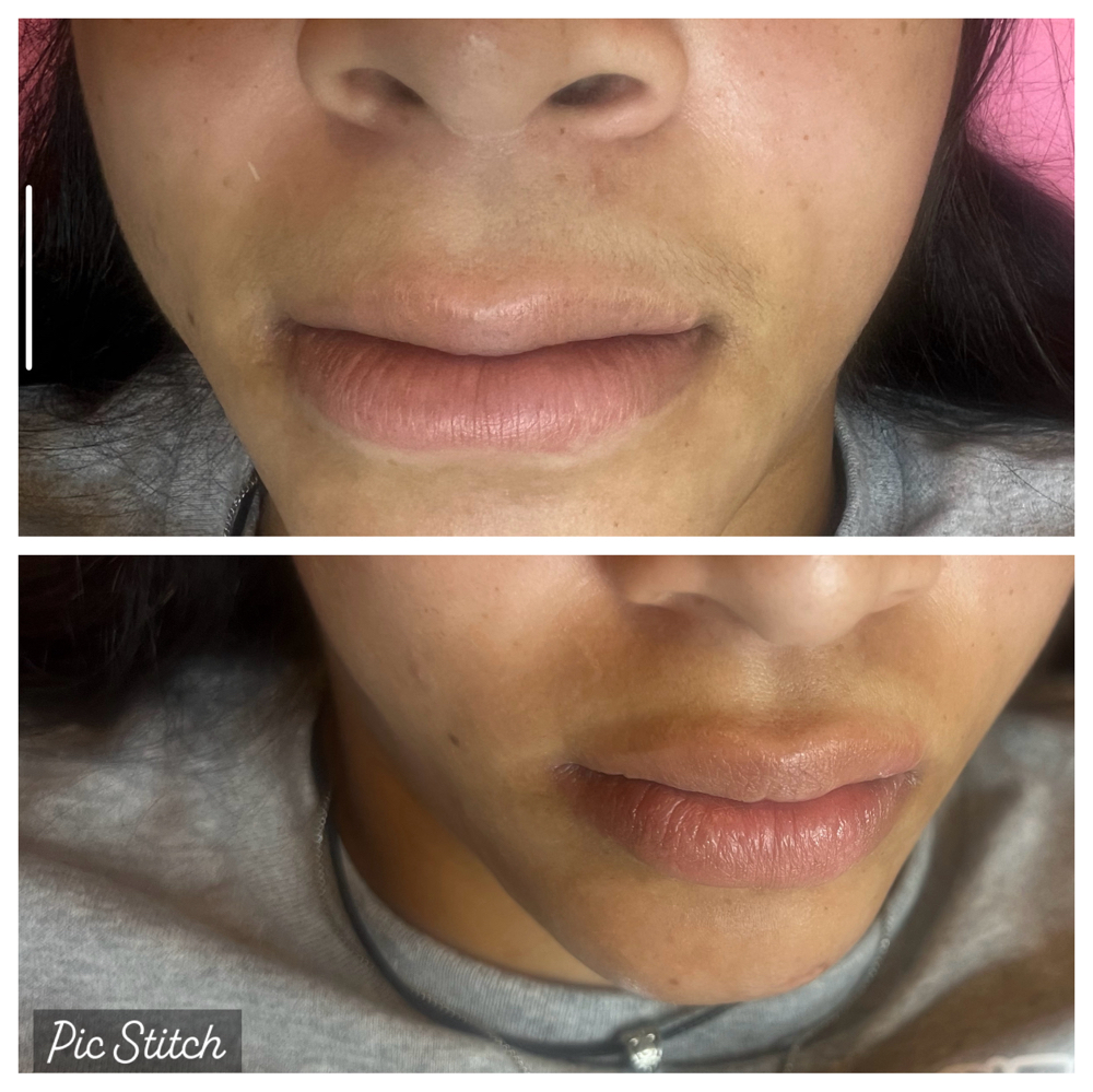 Lips