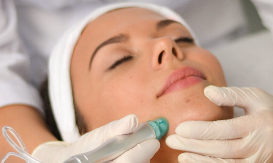 Hydrodermabrasion & Oxygen Infusion