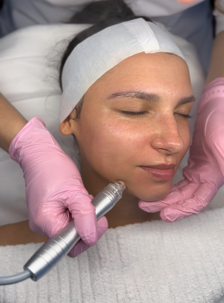 HydrodiamondFacial