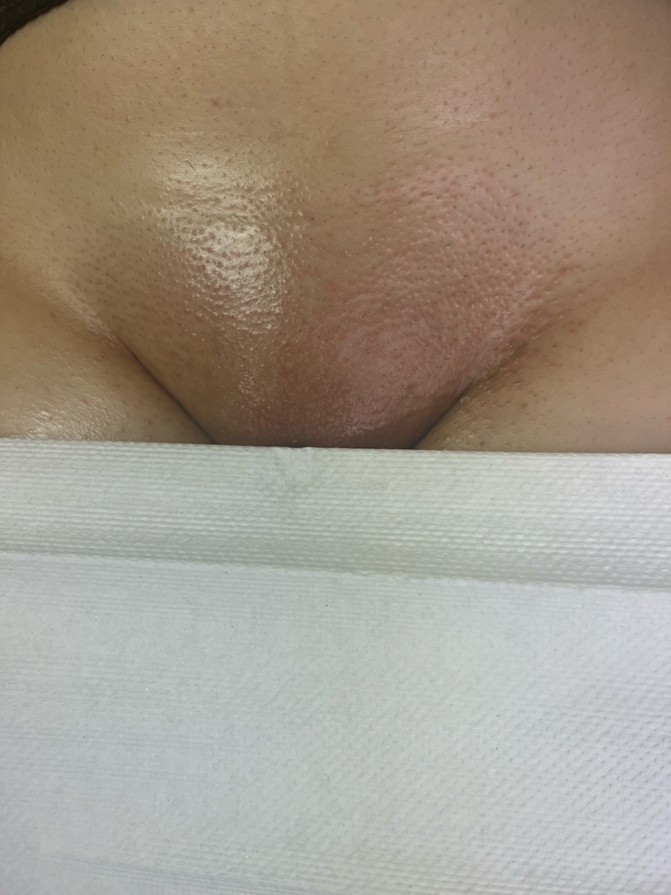 Brazilian Wax