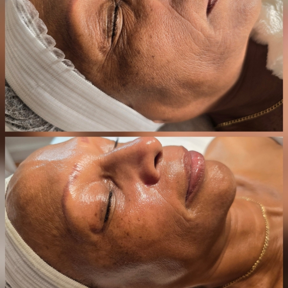 LUXURY ANTI-AGING FACIAL at Palomabeautyglow in Smithtown, NY