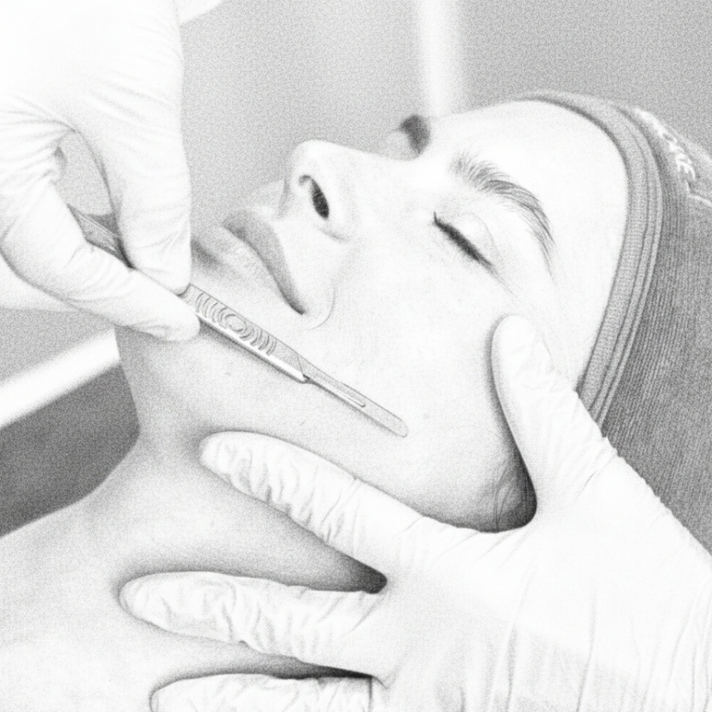 Dermaplanning Facial at Unique Faces in Dundee, FL