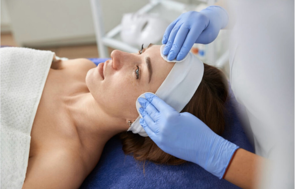 Chemical peel