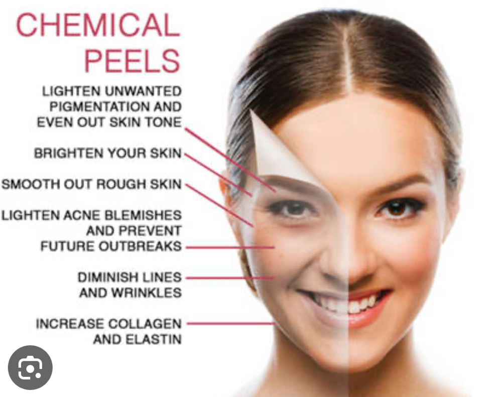 Healthy Aging Peel  TCA (3)