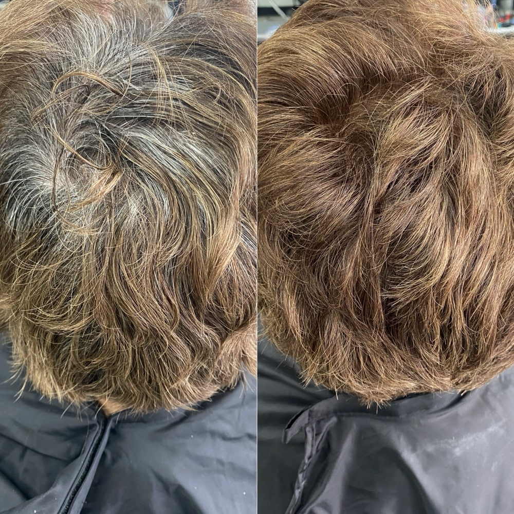 Root Retouch