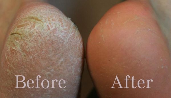 Signature Pedicure