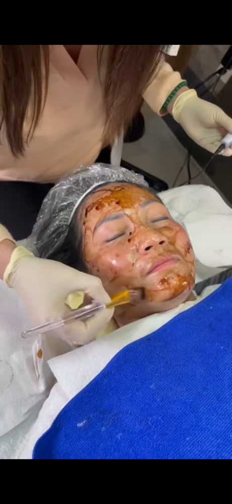 Red Gingeng Nano Infusion Facial