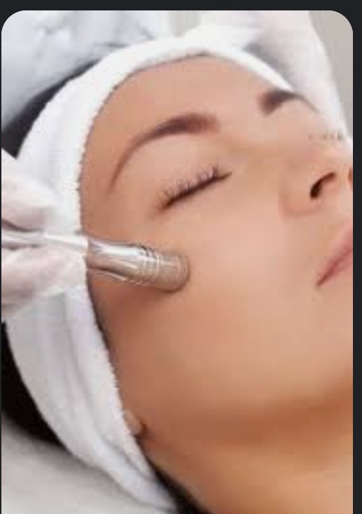 Microdermabrasion Facial