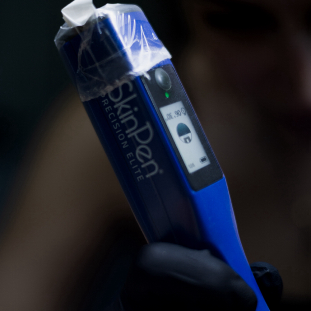 SkinPen Package of 3 at Jade Esthetics in Oviedo, FL