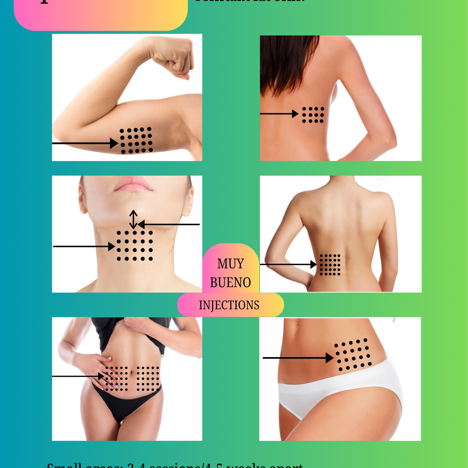 LipoDissolve at Muy Bueno Injections by Pat MSN RN in San Antonio, TX