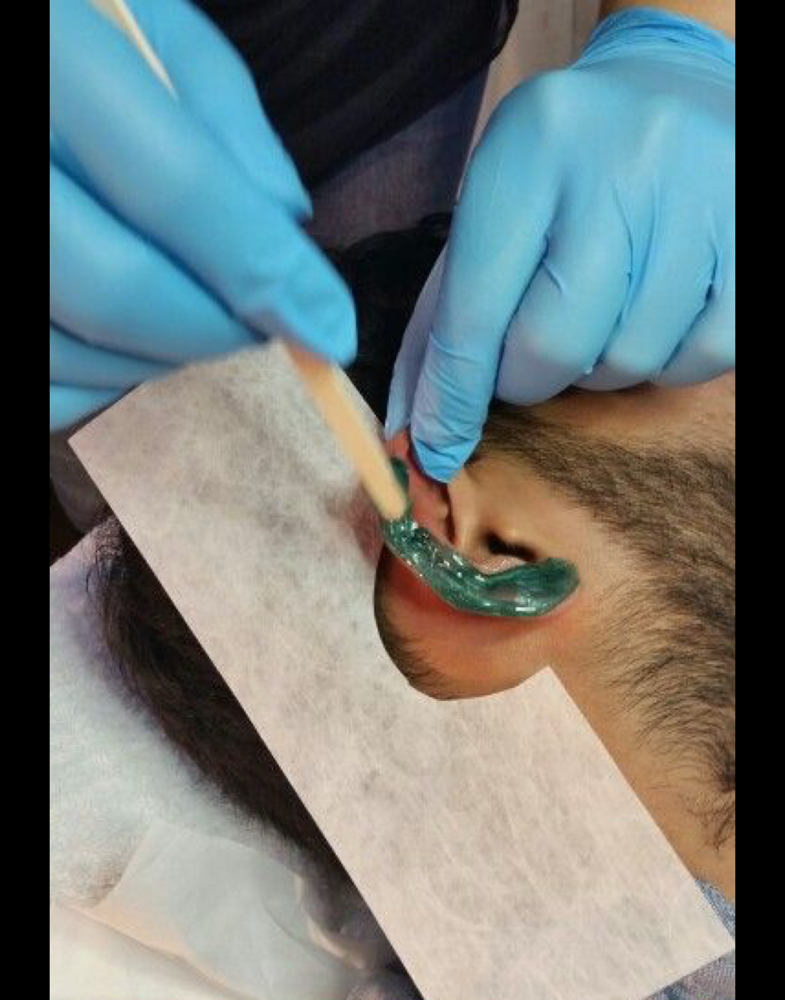 Ear Wax