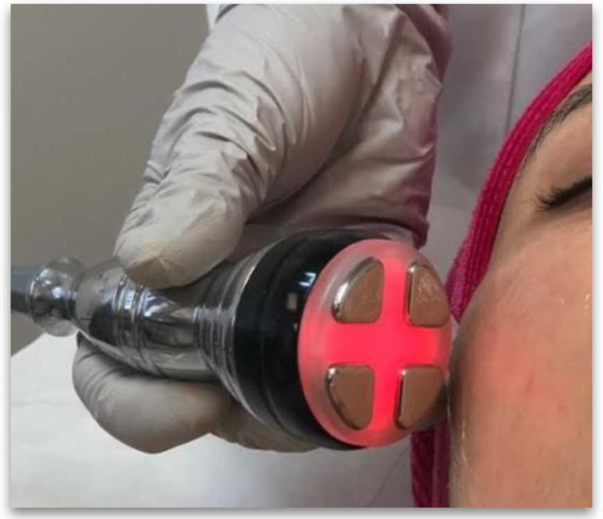 Add on - Electroporation