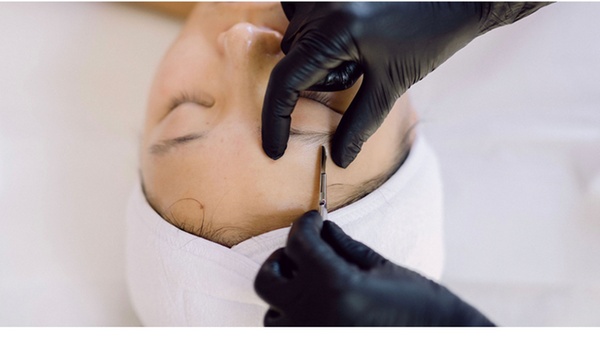 Express Dermaplaning