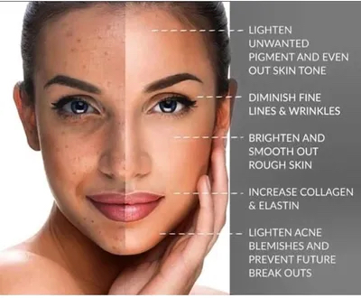 Microneedling & Red Light Therapy at STERLING INK & GLO in El Cajon, CA