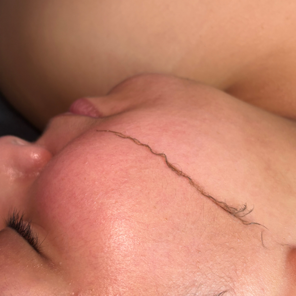 Dermaplane ADD ON at Solace Skin Revival in Corpus Christi, TX
