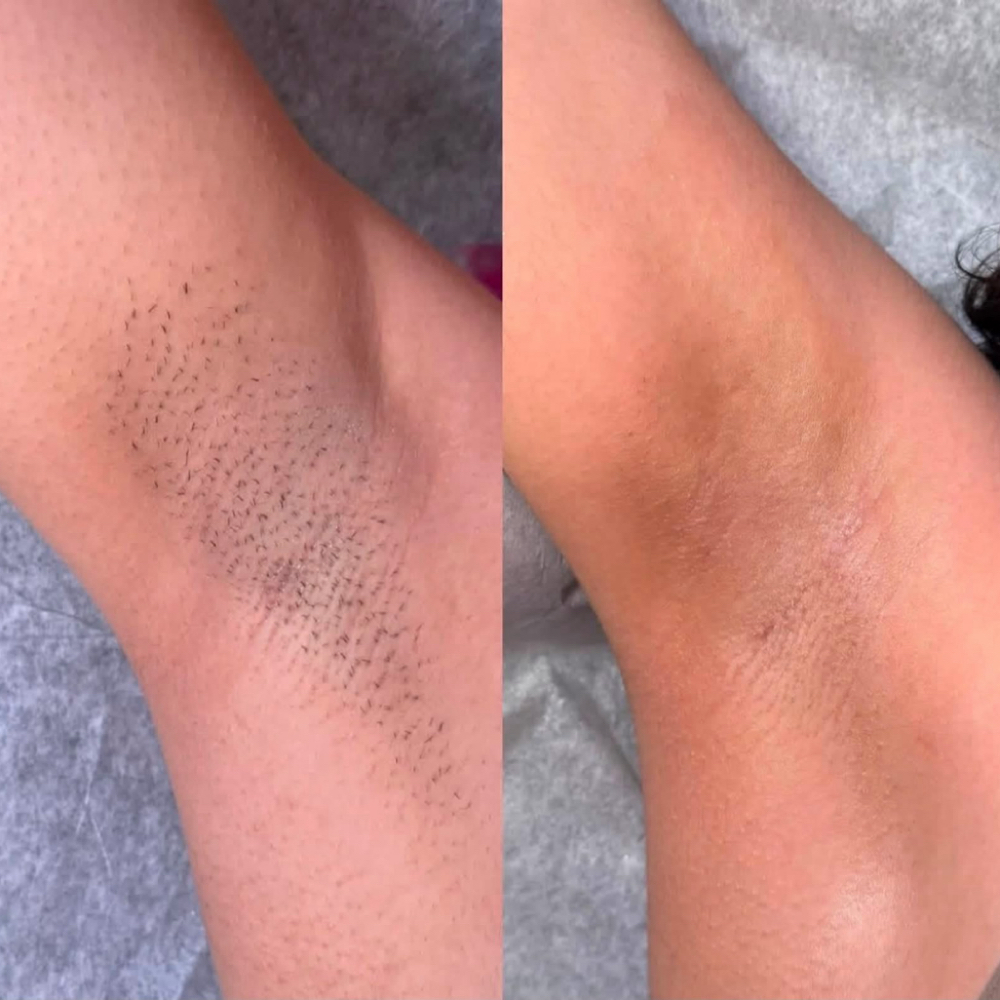 Underarm Wax at Blush & Bloom in Claremore, OK