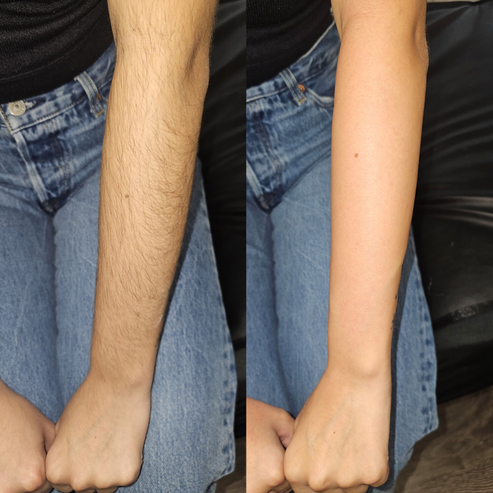 Lower Arm Wax at Bubalu Skin in Elgin, IL