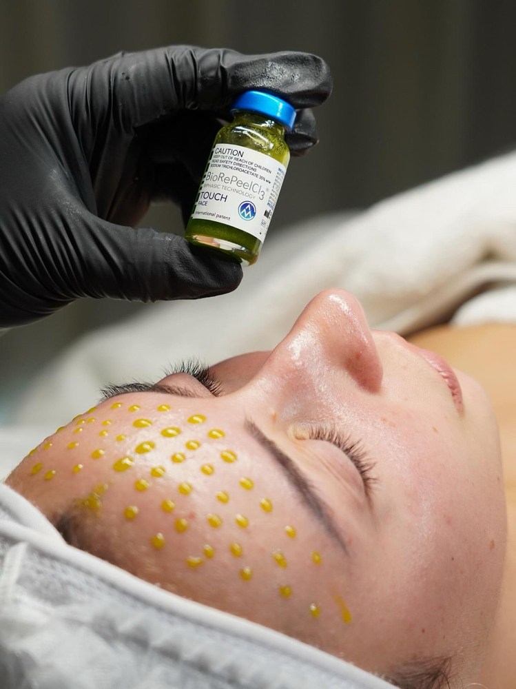 BioRePeel at Zoraya Velez AESTHETICIAN in Richmond, VA