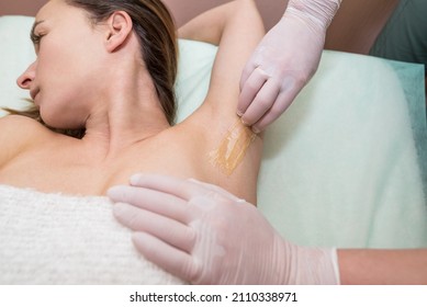 Underarms