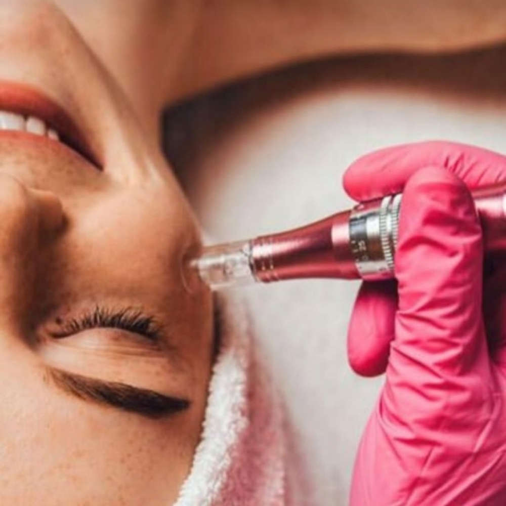 Microneedling Single Session at Halo Aesthetics Center in Harrison, NJ
