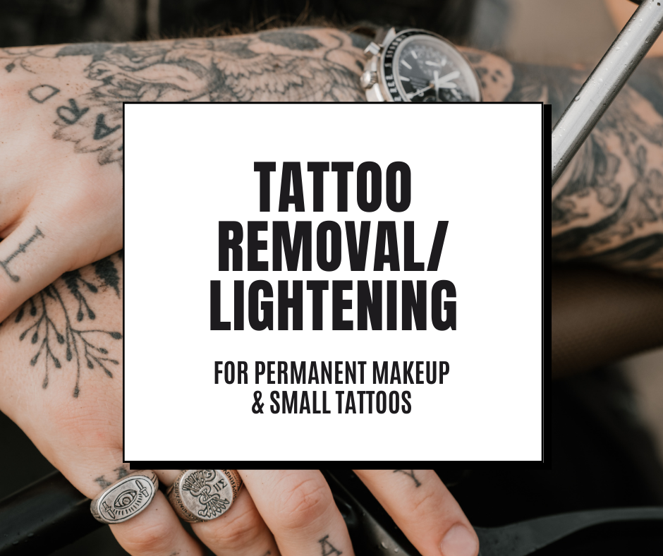 Tattoo Removal/Lightening