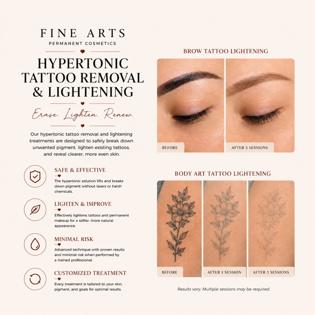 Tattoo Removal/Lightening at Fine Arts Permanent Cosmetics in Xxxxx, AZ