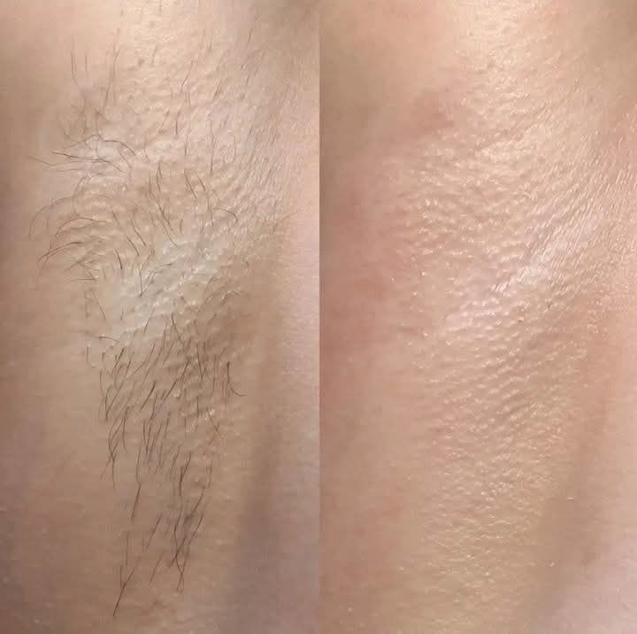 Underarm Wax