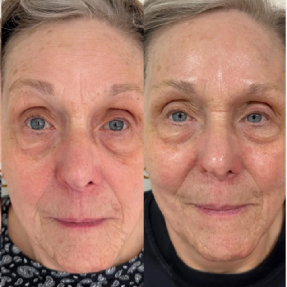 Rejuragen Facial at Skin Love Worthington in Worthington, OH