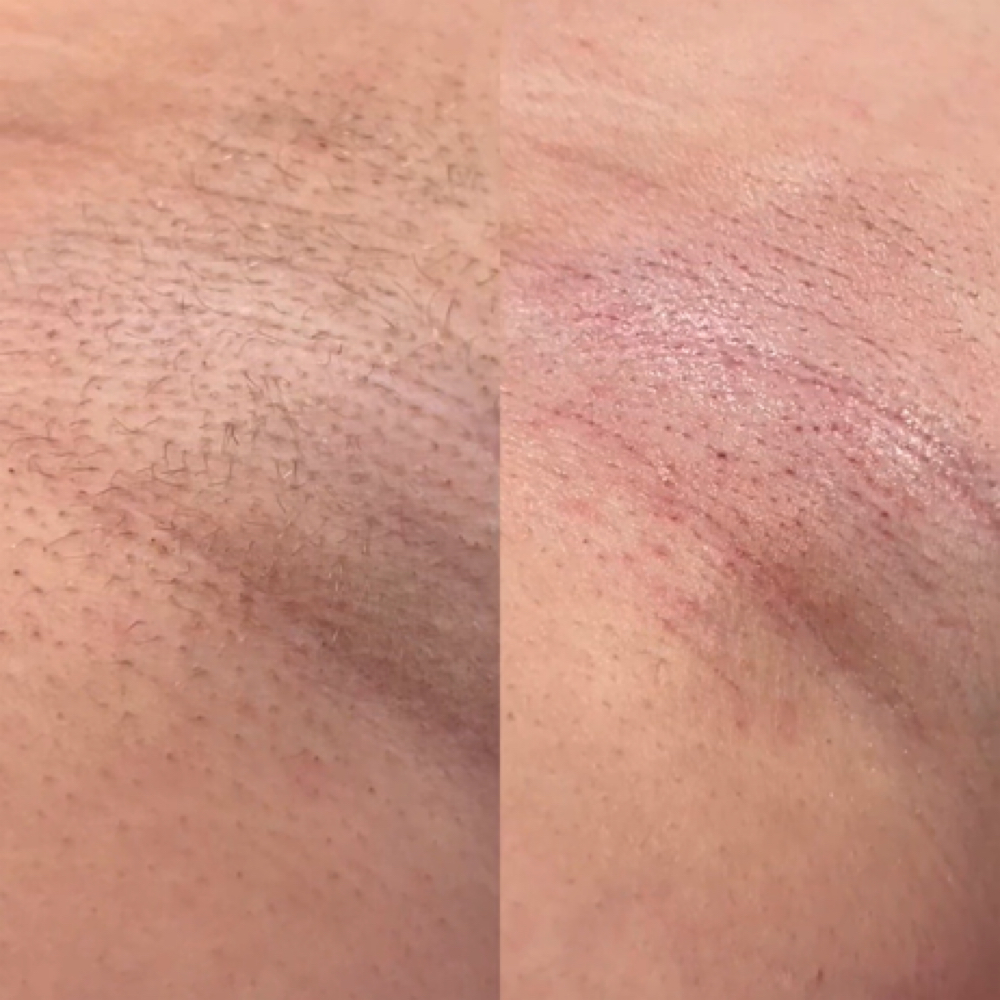 Underarm Wax at facialsbylashay in peru, IN