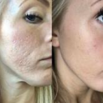 Halo Lift™✨ 3pk