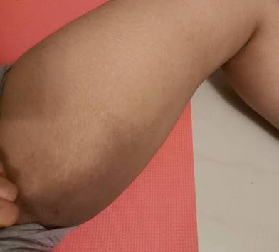 Inner Thigh Brightening