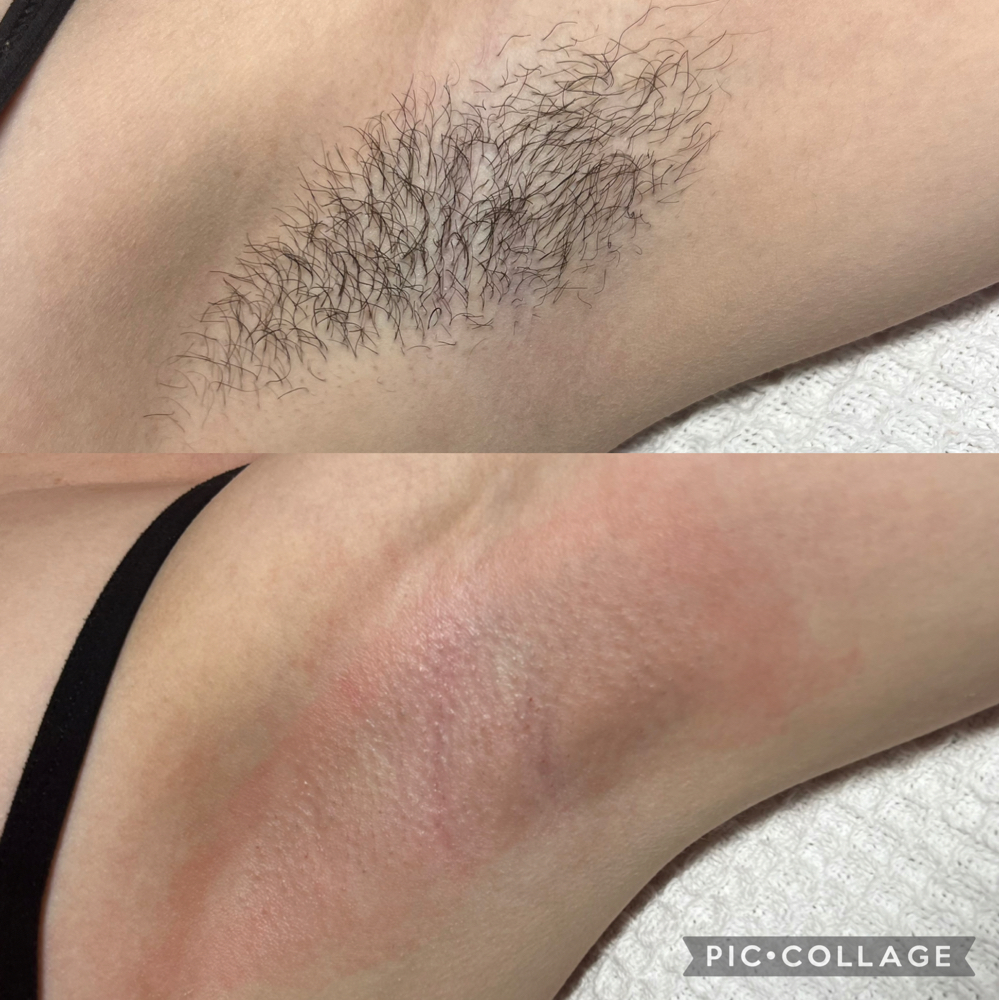 Underarm Wax