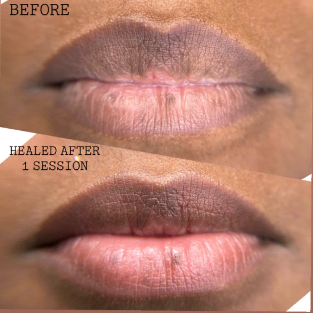 Lip Blush Neutralization at Chanti’s Beauty Loft in NC, NC