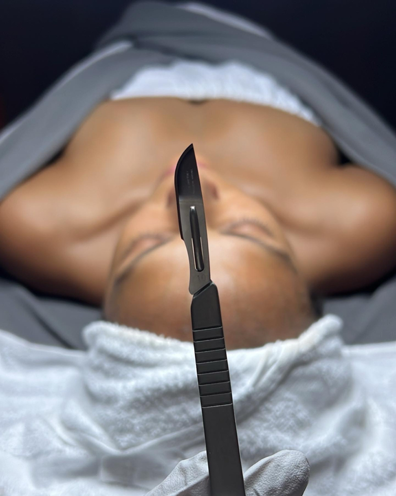 Dermaplane Facial