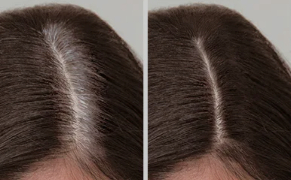 ROOT TOUCH UP + BLOWDRY