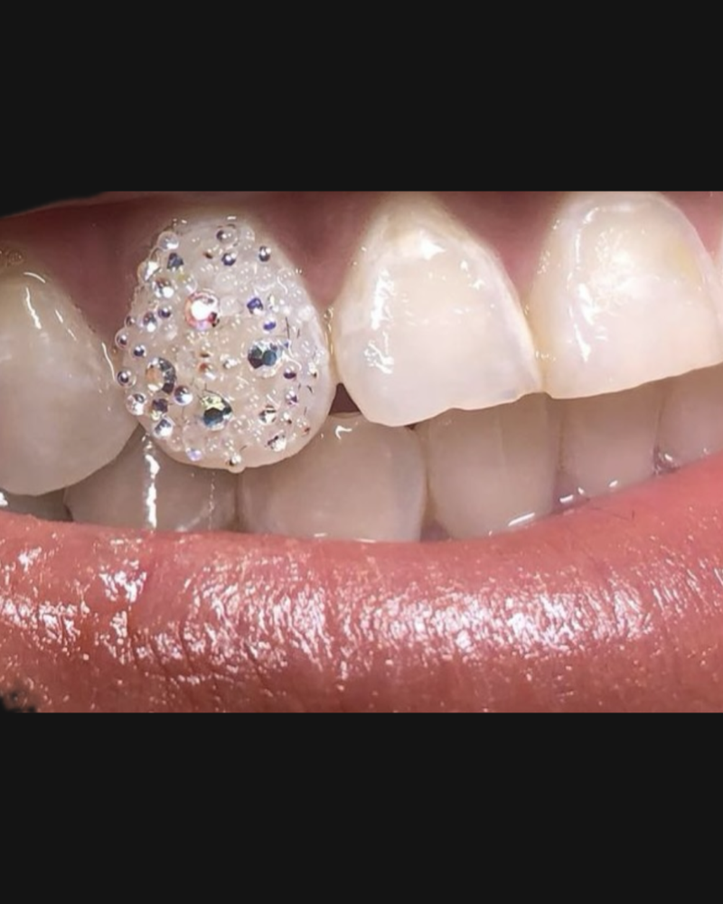 Chandelier Tooth