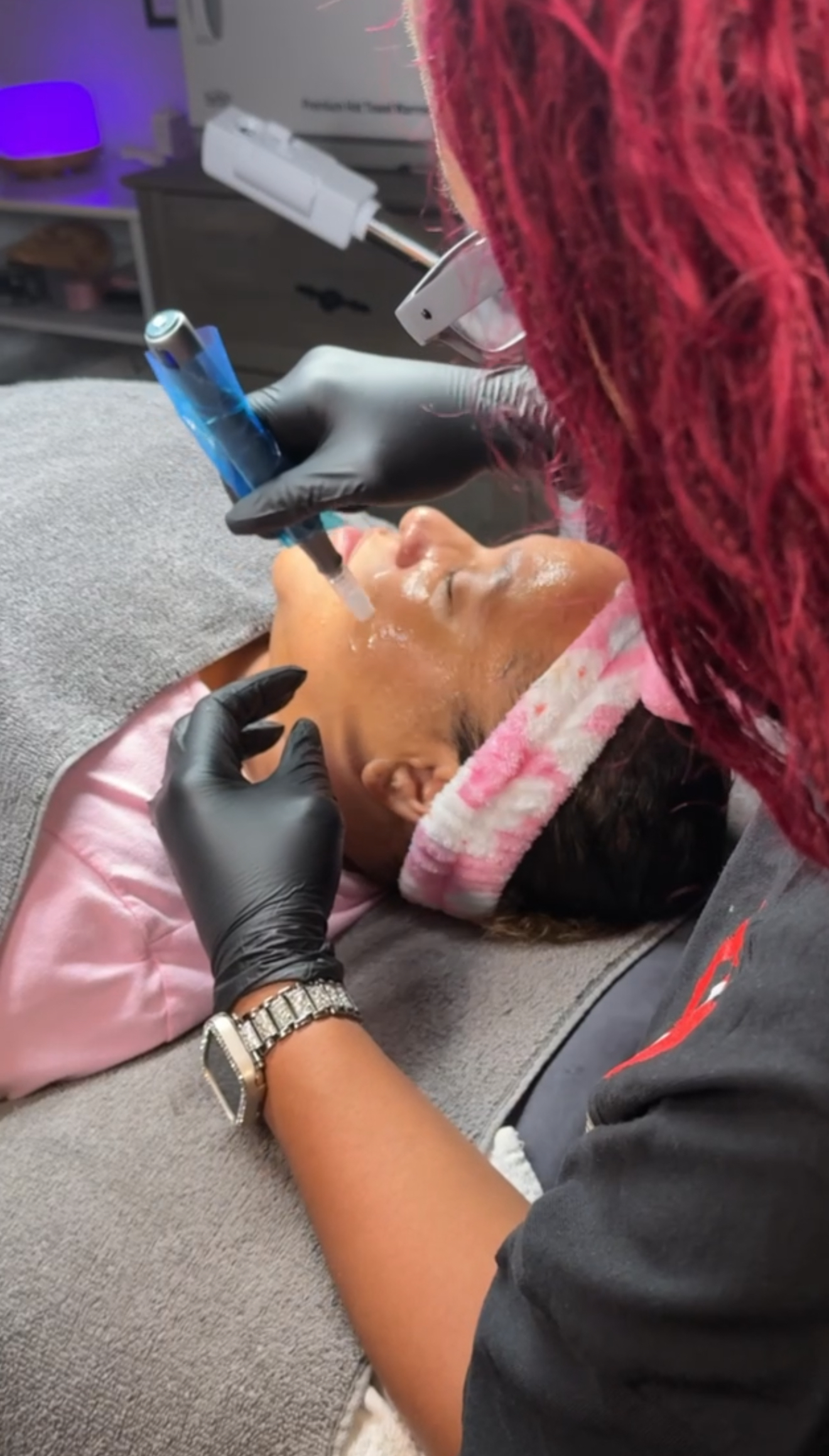 ✨MICRONEEDLING/NANO INFUSION FACIAL