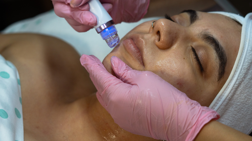 Hydro-Dermabrasion Facial🫧🌿