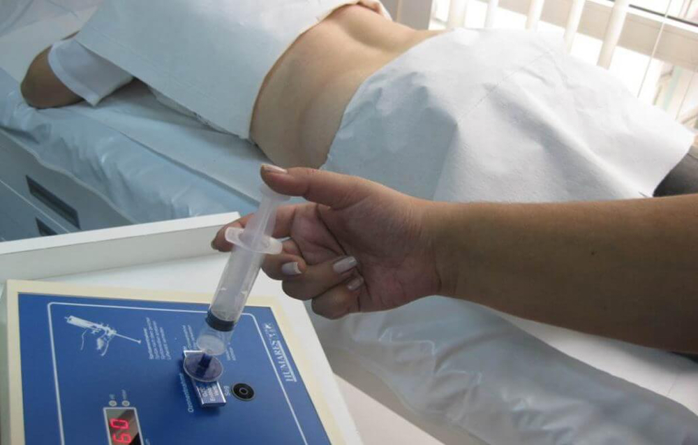 Ozone Therapy