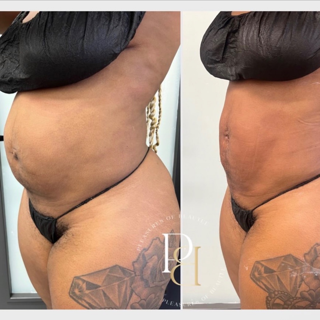 All-Inclusive 1-Area Package at Pleasures of Beautee in Atlanta, GA