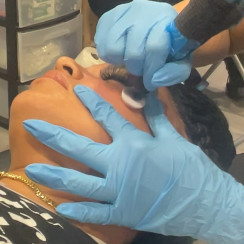 Microchanneling w/Stem Cell at Beyond Esthetics Studio in Brandon, FL
