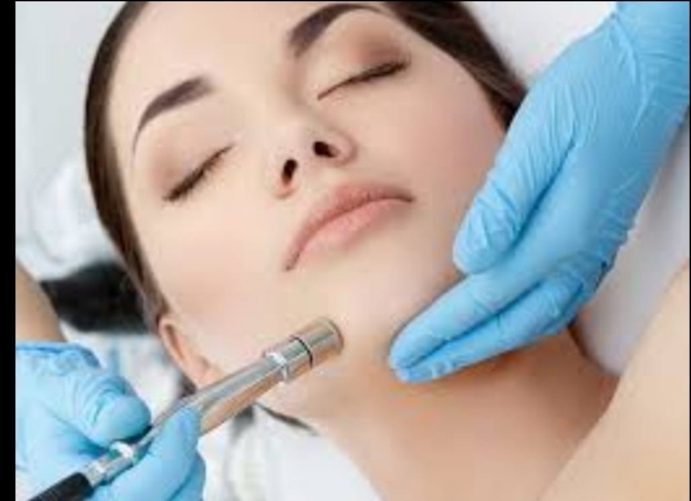 Microdermabrasion