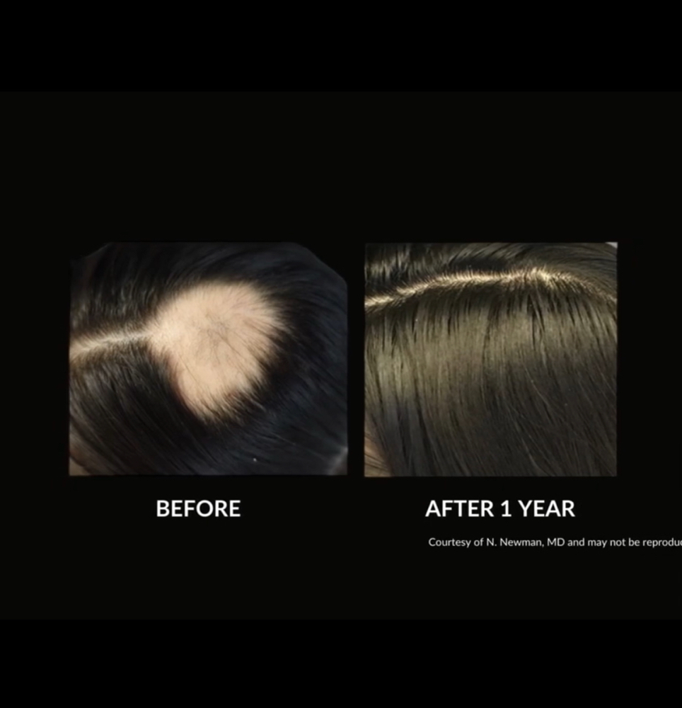 De/Rive Hair Restoration