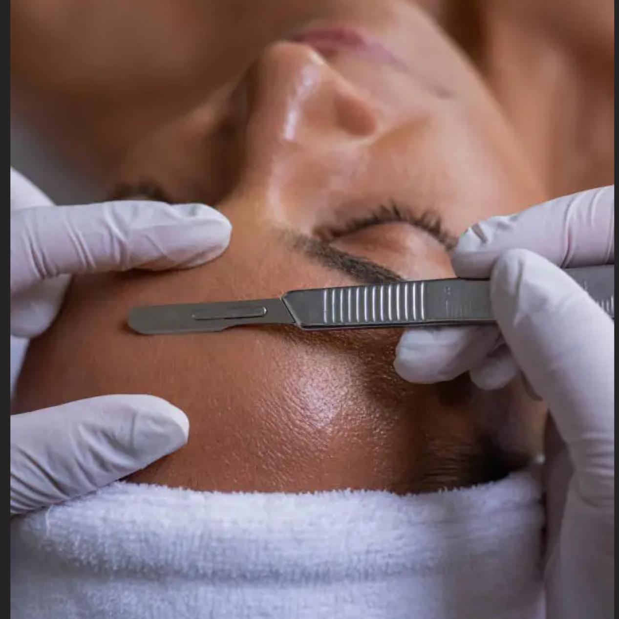 Dermaplaning Glow Facial at Nox Skin Co in Palmyra, ME