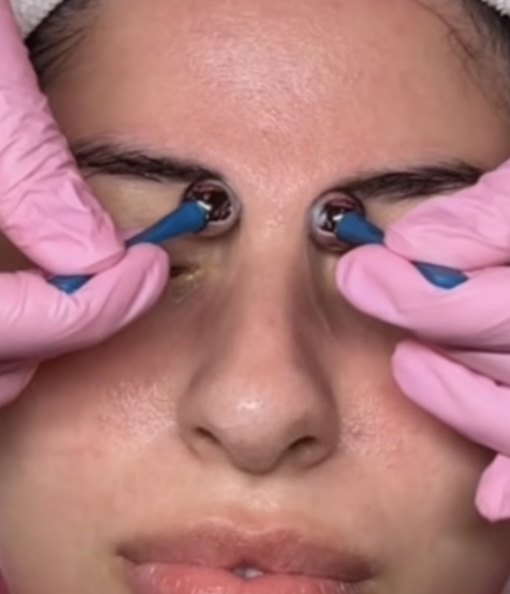 Under Eye Massage | Add On