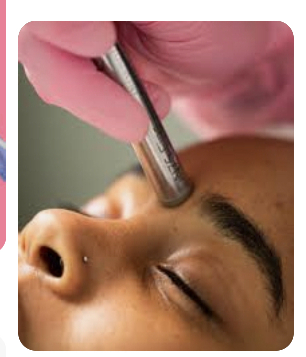 Microdemabrasion