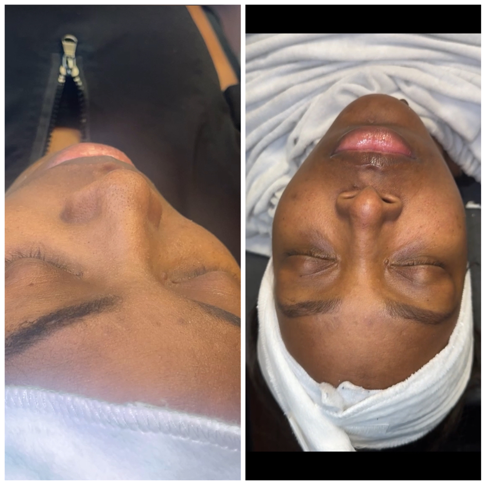 Anti-Aging Facial