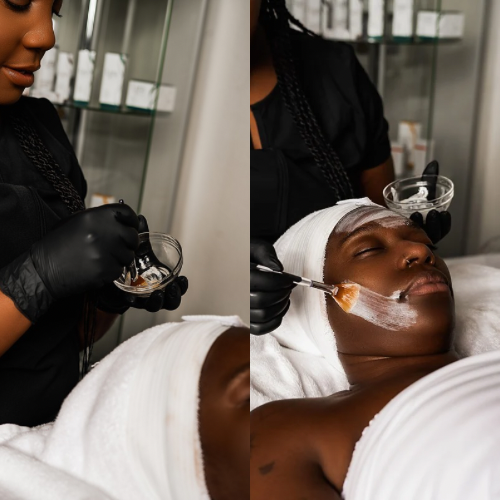 Chemical Peel Preparation