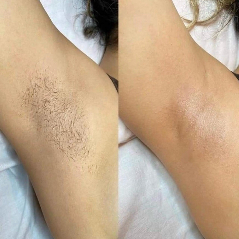 Underarm Wax at Blessed Beauty Aesthetics, LLC in Houston, TX